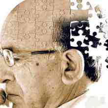 جدیدترین روش‌های درمان آلزایمر