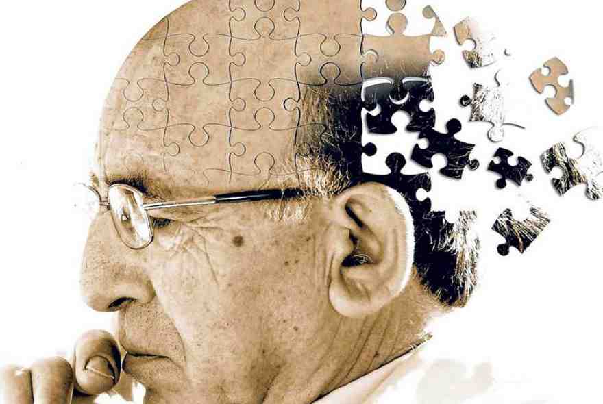 جدیدترین روشهای درمان آلزایمر جدیدترین روشهای درمان آلزایمر